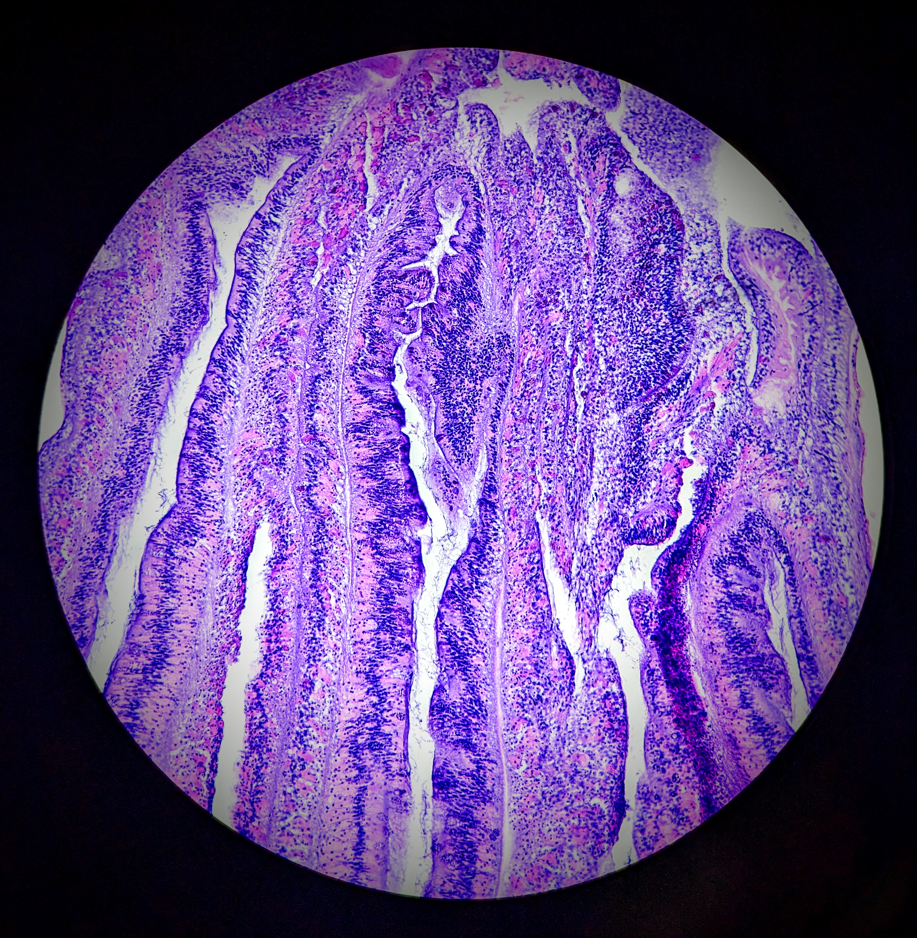 Pillar coral tissues seen through a microscope.