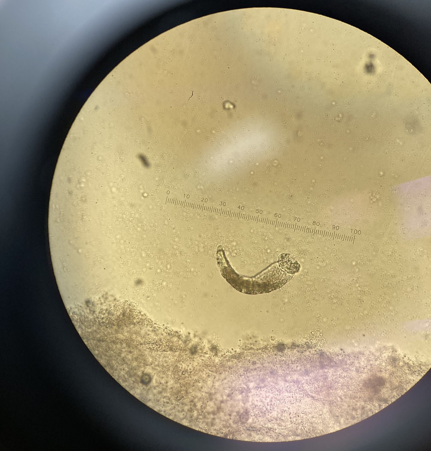 Fish parasite shown through a microscope