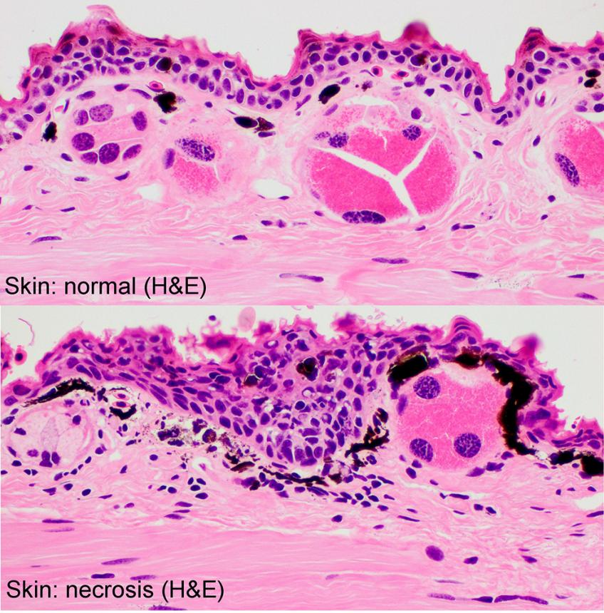 Histo slide of a newt's skin; examples of a normal and necrosis affected sample