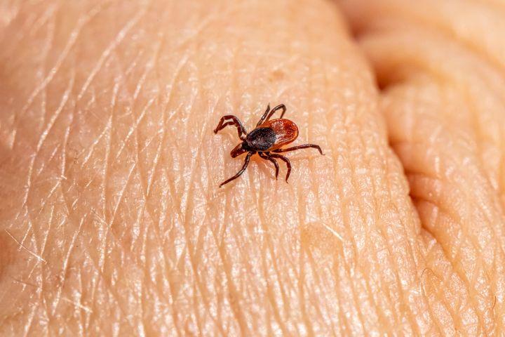 Tick on human skin.